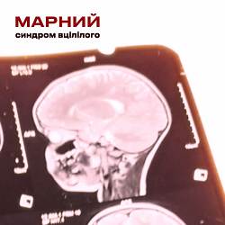 Марний - Синдром вцілілого